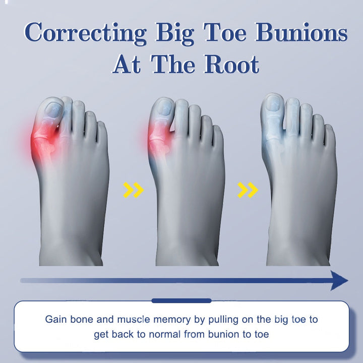 Premium Toe Alignment Support Adjustable Bunion Corrector Hallux Valgus Toe Separator Rotatable Splint Non Slip Big Toe Brace for Daily Use Comfort Fit