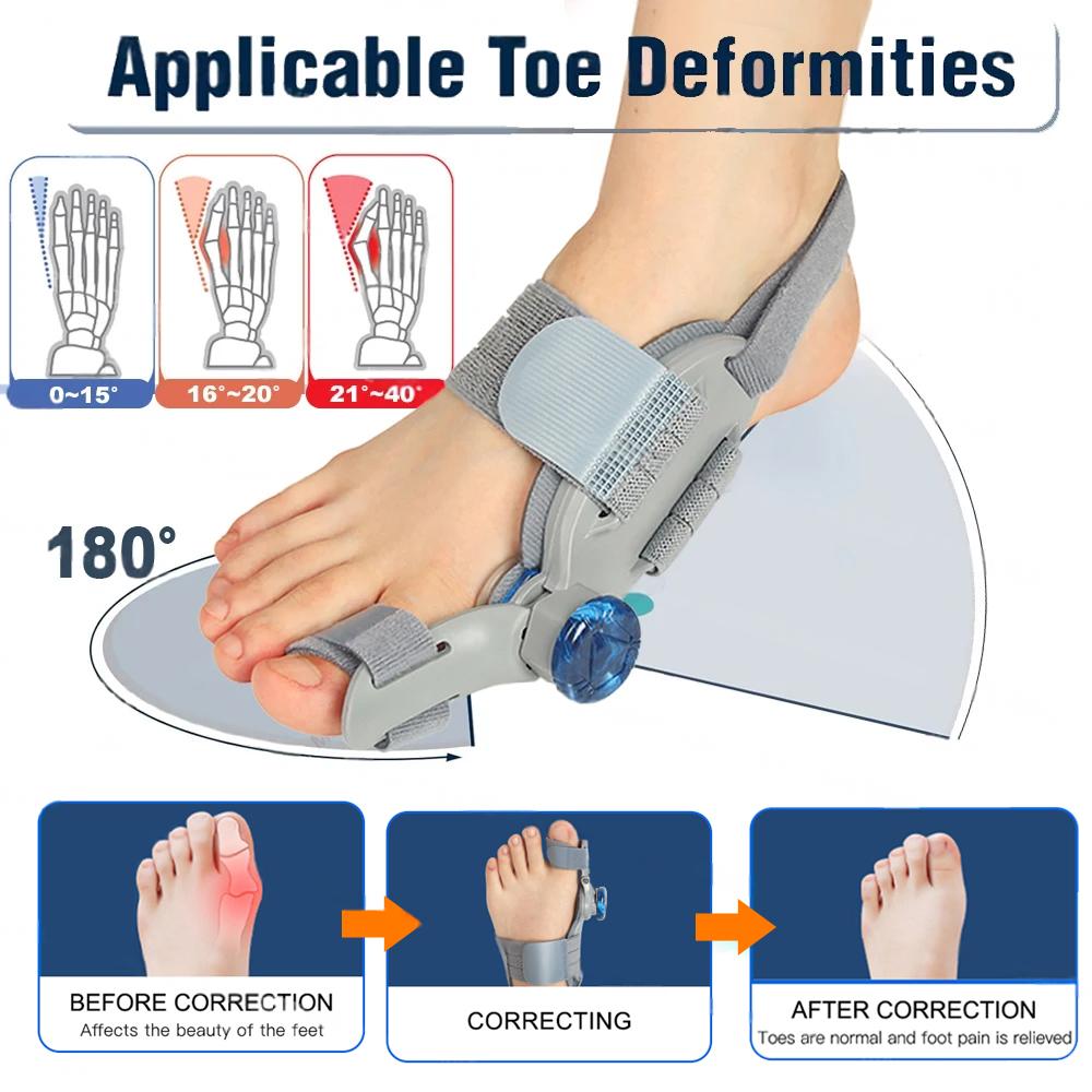 Premium Toe Alignment Support Adjustable Bunion Corrector Hallux Valgus Toe Separator Rotatable Splint Non Slip Big Toe Brace for Daily Use Comfort Fit