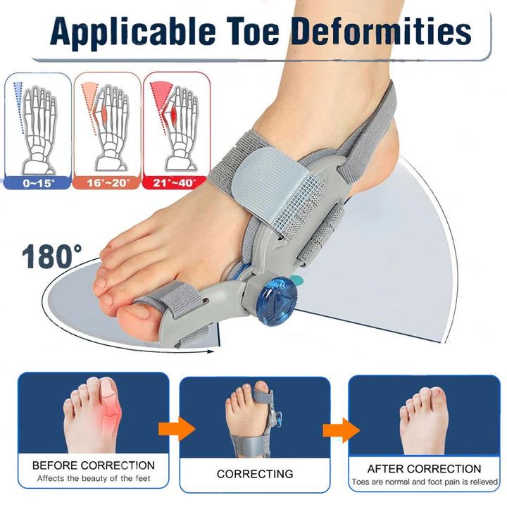 Premium Toe Alignment Support Adjustable Bunion Corrector Hallux Valgus Toe Separator Rotatable Splint Non Slip Big Toe Brace for Daily Use Comfort Fit