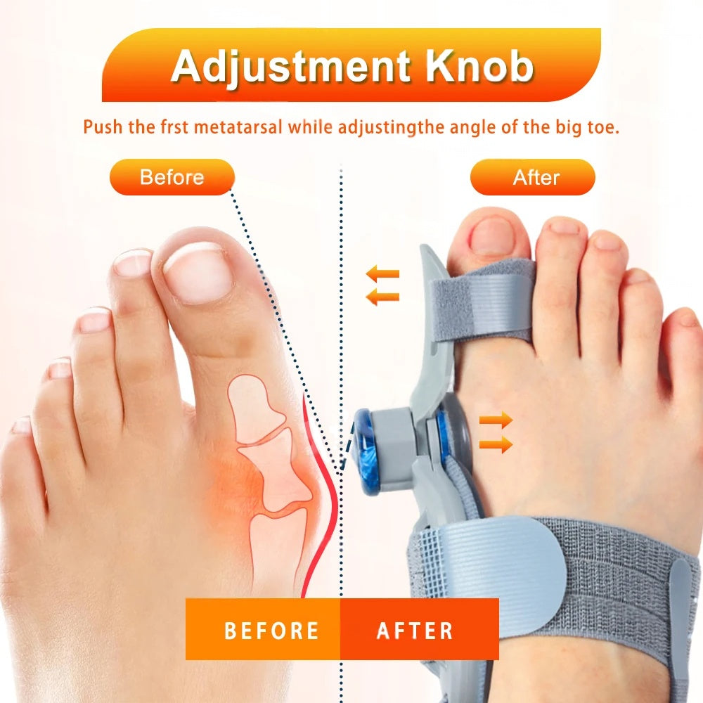 Premium Toe Alignment Support Adjustable Bunion Corrector Hallux Valgus Toe Separator Rotatable Splint Non Slip Big Toe Brace for Daily Use Comfort Fit