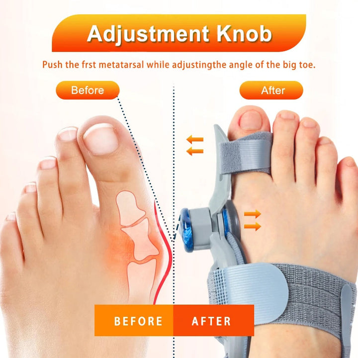 Premium Toe Alignment Support Adjustable Bunion Corrector Hallux Valgus Toe Separator Rotatable Splint Non Slip Big Toe Brace for Daily Use Comfort Fit