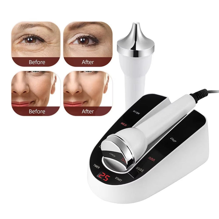 Premium Ultrasonic Beauty Device 1MHz Facial Massager Eye Face Care Machine Portable Skin Care Tool High Frequency Ultrasonic Cleaner for Home Daily Use