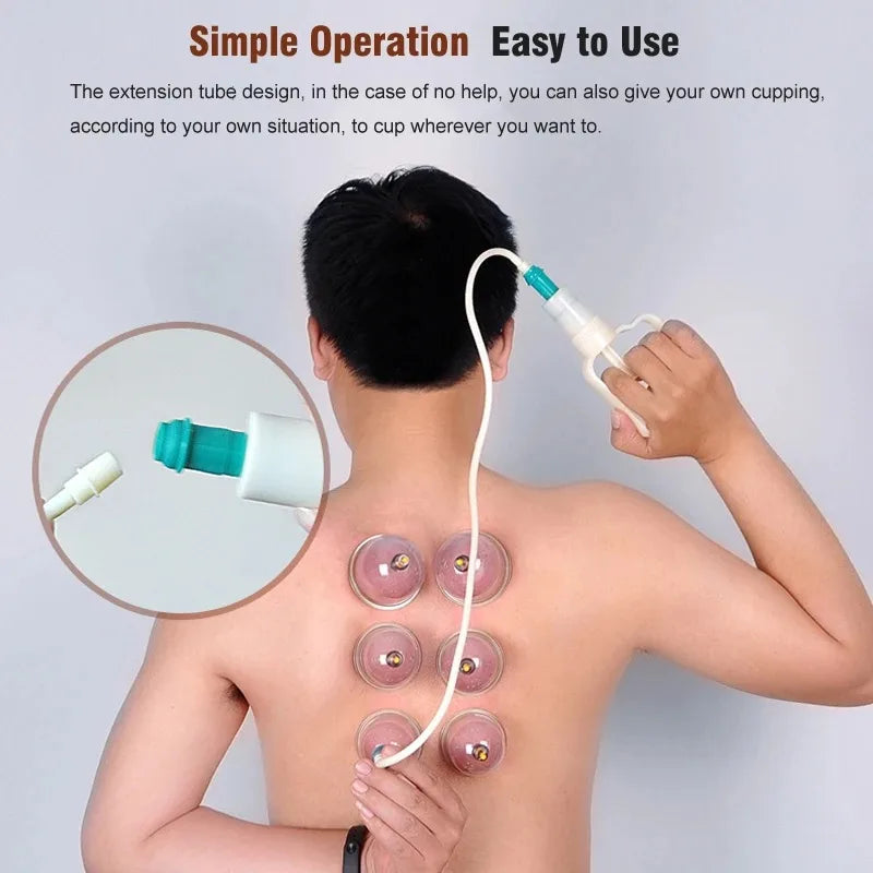 Premium Vacuum Cupping Set Suction Cups Hand Pump Plastic Cups 6 12 24 Piece Massage Kit Portable Body Cups for Home Clinic Daily Use Comfort